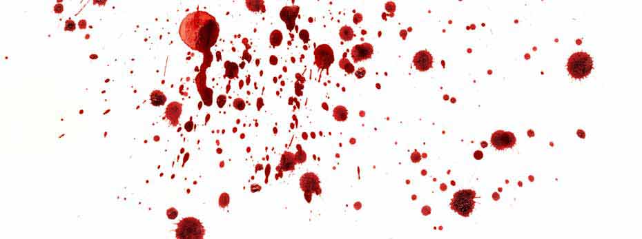 Image result for blood spatter